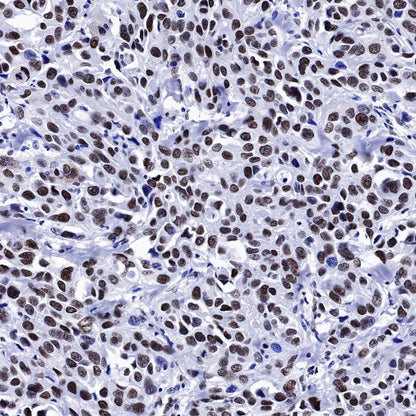 NuMA Recombinant Rabbit mAb (SDT-474-241)