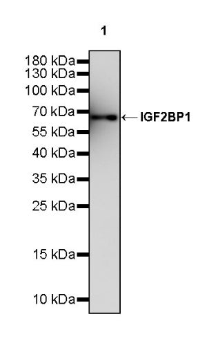 IGF2BP1 Recombinant Rabbit mAb (S-2947-19)