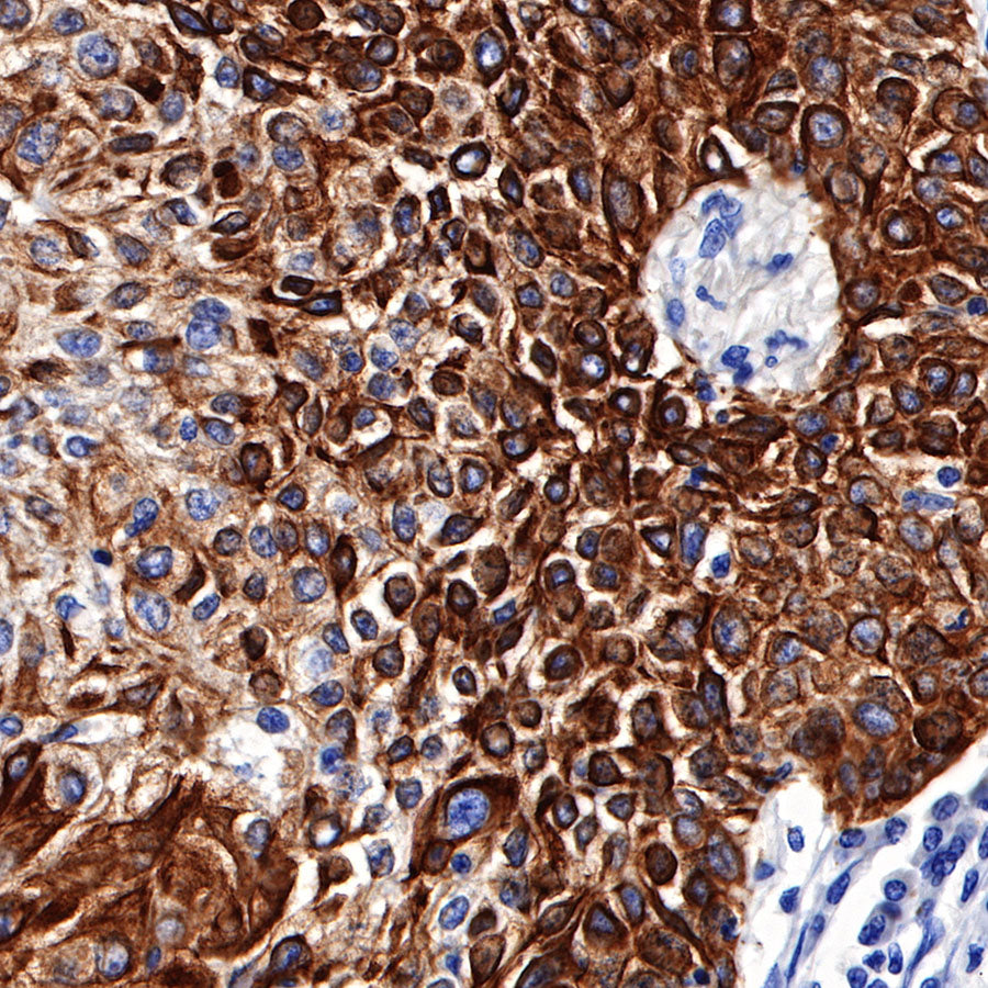 S-RMab® CK5/6 Recombinant Rabbit mAb,PBS Only (SDT-P004)