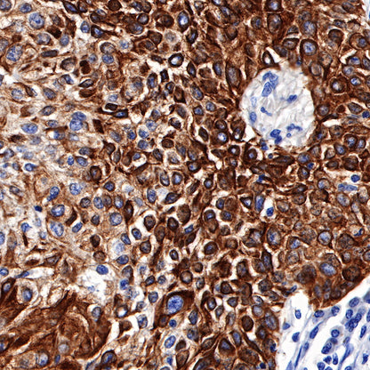 S-RMab® CK5/6 Recombinant Rabbit mAb,PBS Only (SDT-P004)