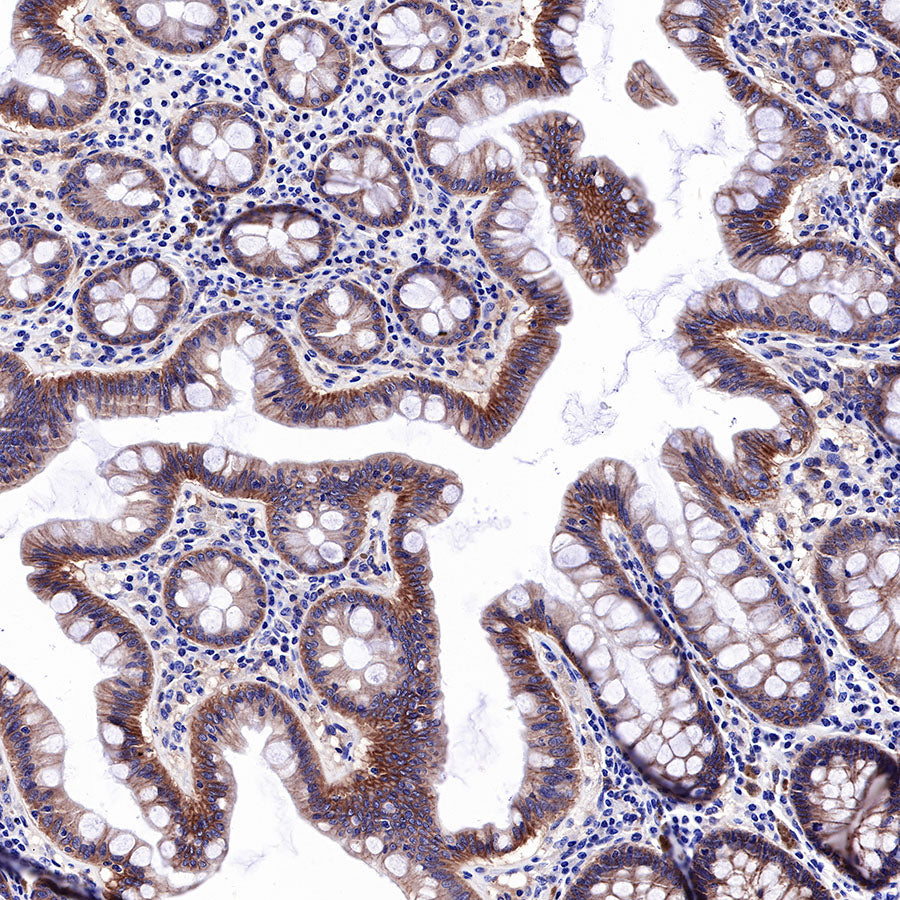 EGFR Recombinant Rabbit mAb (SDT-R110)