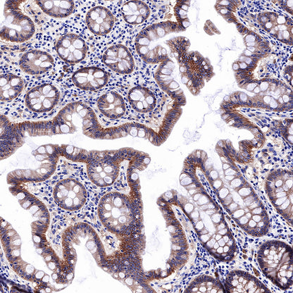 EGFR Recombinant Rabbit mAb (SDT-R110)