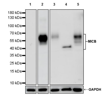 MICB Recombinant Rabbit mAb (S-1472-102)