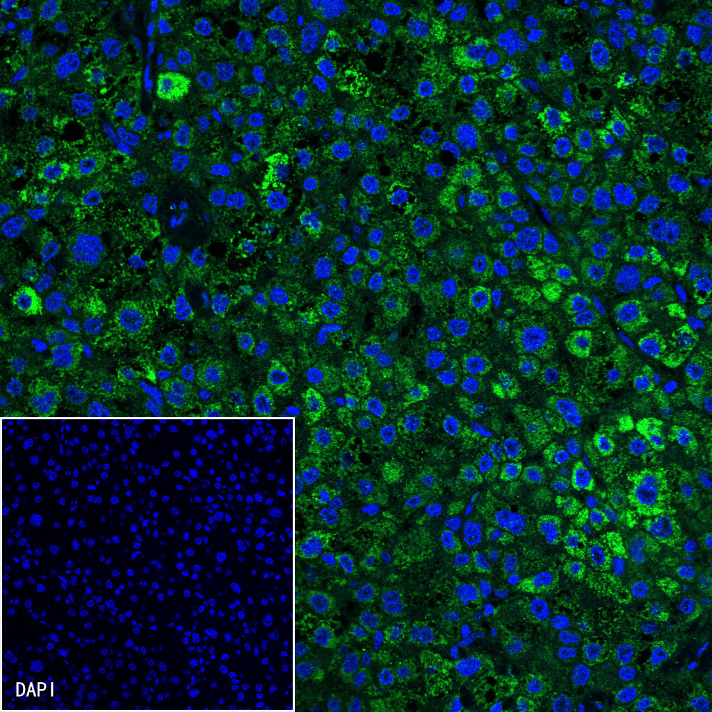 Glypican-3 Recombinant Rabbit mAb,PBS Only (SDT-R032)