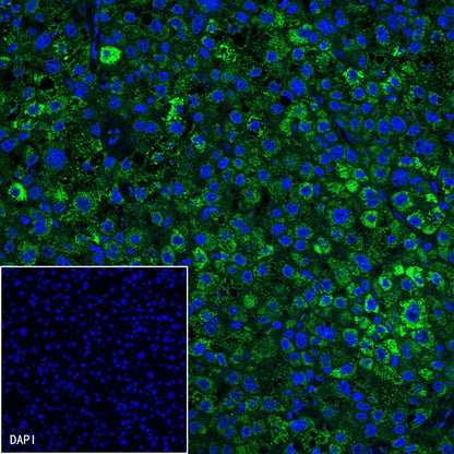 Glypican-3 Recombinant Rabbit mAb,PBS Only (SDT-R032)