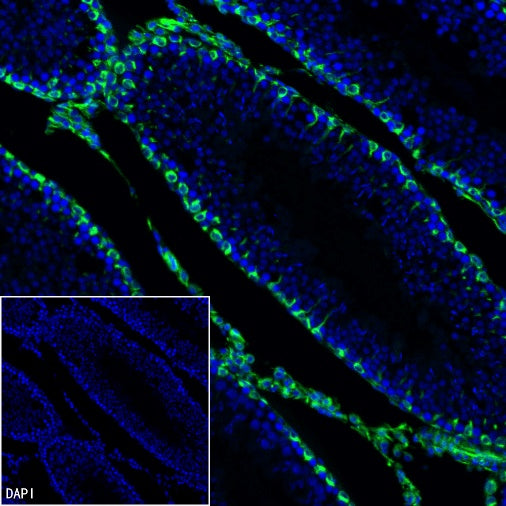 Vimentin Recombinant Rabbit mAb (Alexa Fluor® 488 Conjugate) (S-029-20)