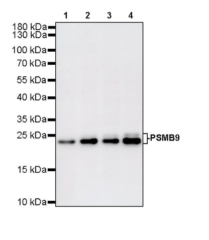 PSMB9 Recombinant Rabbit mAb (S-4183-122)