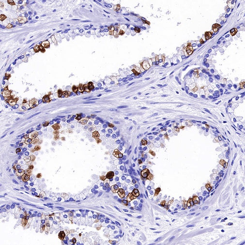MUC4 Recombinant Rabbit mAb (SDT-R228)