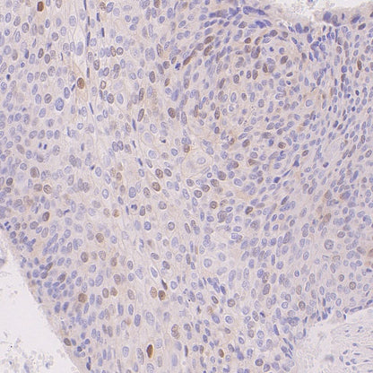 Cyclin A2 Recombinant Rabbit mAb (S-1873-103)