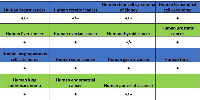 SDHA Recombinant Rabbit mAb (S-1458-43)