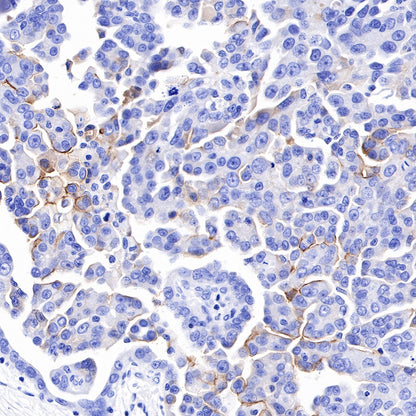 S-RMab® Mesothelin Recombinant Rabbit mAb (SDT-R070)