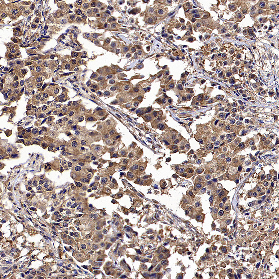 Calpain 1 Recombinant Rabbit mAb (S-3797-41)