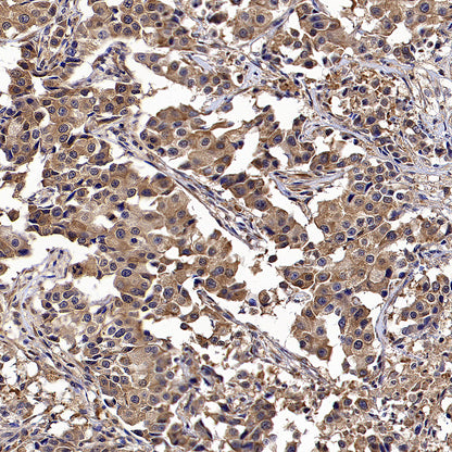 Calpain 1 Recombinant Rabbit mAb (S-3797-41)