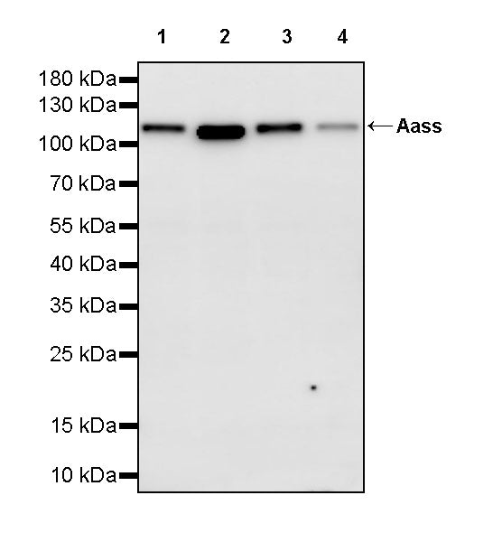 Aass Recombinant Rabbit mAb (S-4170-22)