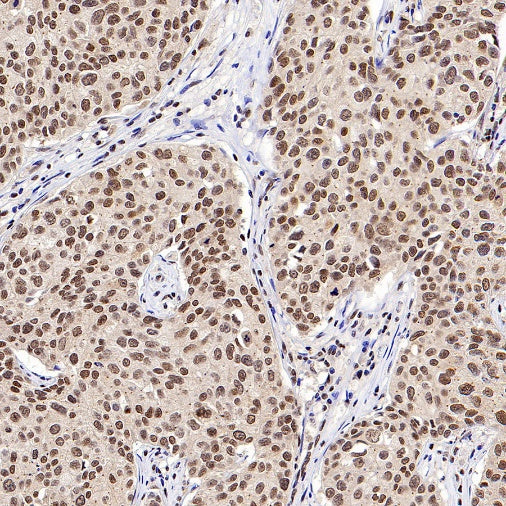 CTCF Recombinant Rabbit mAb (S-1822-42)