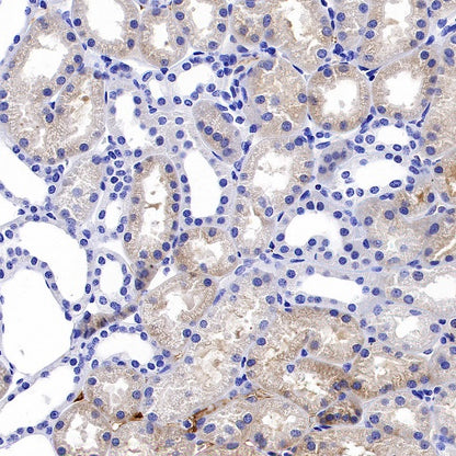 Citrate synthetase Recombinant Rabbit mAb (S-1708-56)