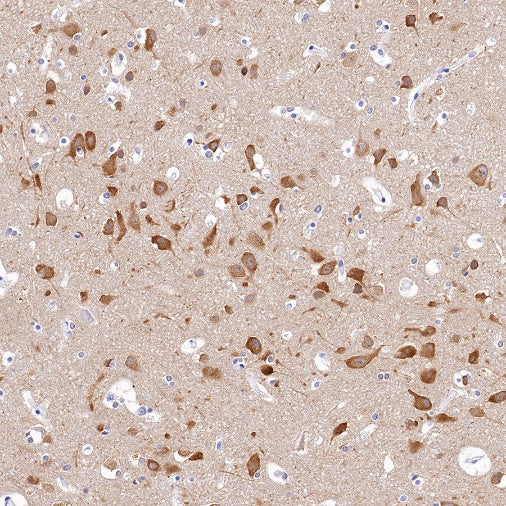 LC3A/B Recombinant Rabbit mAb (S-1367-104)
