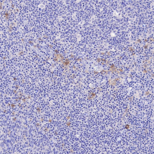 FCER1A/FcεRIα Recombinant Rabbit mAb (S-1697-174)