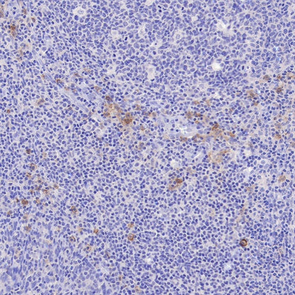 FCER1A/FcεRIα Recombinant Rabbit mAb (S-1697-174)