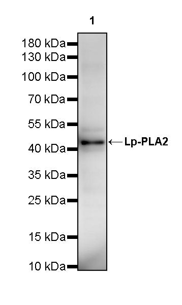 Lp-PLA2 Recombinant Rabbit mAb (S-3711-113)