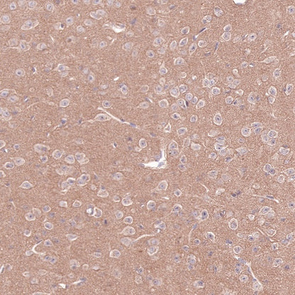 PI3 Kinase p85 Recombinant Rabbit mAb (SDT-R108)