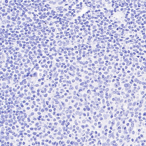 TdT Recombinant Mouse mAb (SDT-4203)