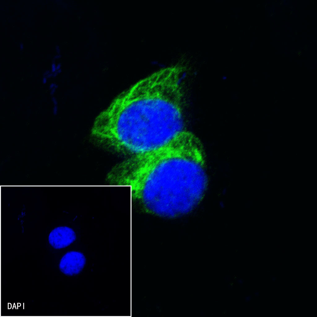 Nestin Recombinant Rabbit mAb (SDT-R112)