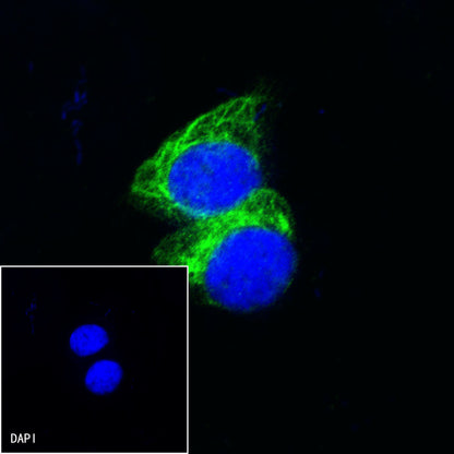 Nestin Recombinant Rabbit mAb (SDT-R112)