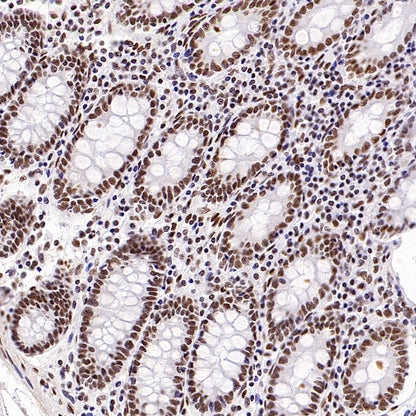 HSF1 Recombinant Rabbit mAb (S-3139-44)