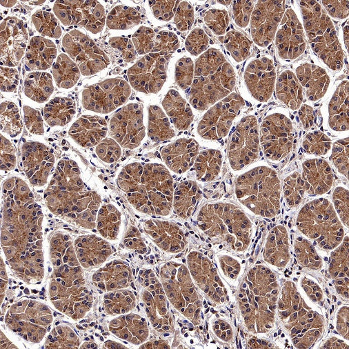 CALHM2 Recombinant Rabbit mAb (S-2671-146)