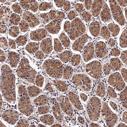 CALHM2 Recombinant Rabbit mAb (S-2671-146)