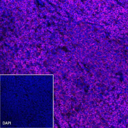 CD45 Recombinant Rabbit mAb (Alexa Fluor® 647 Conjugate) (S-R035)