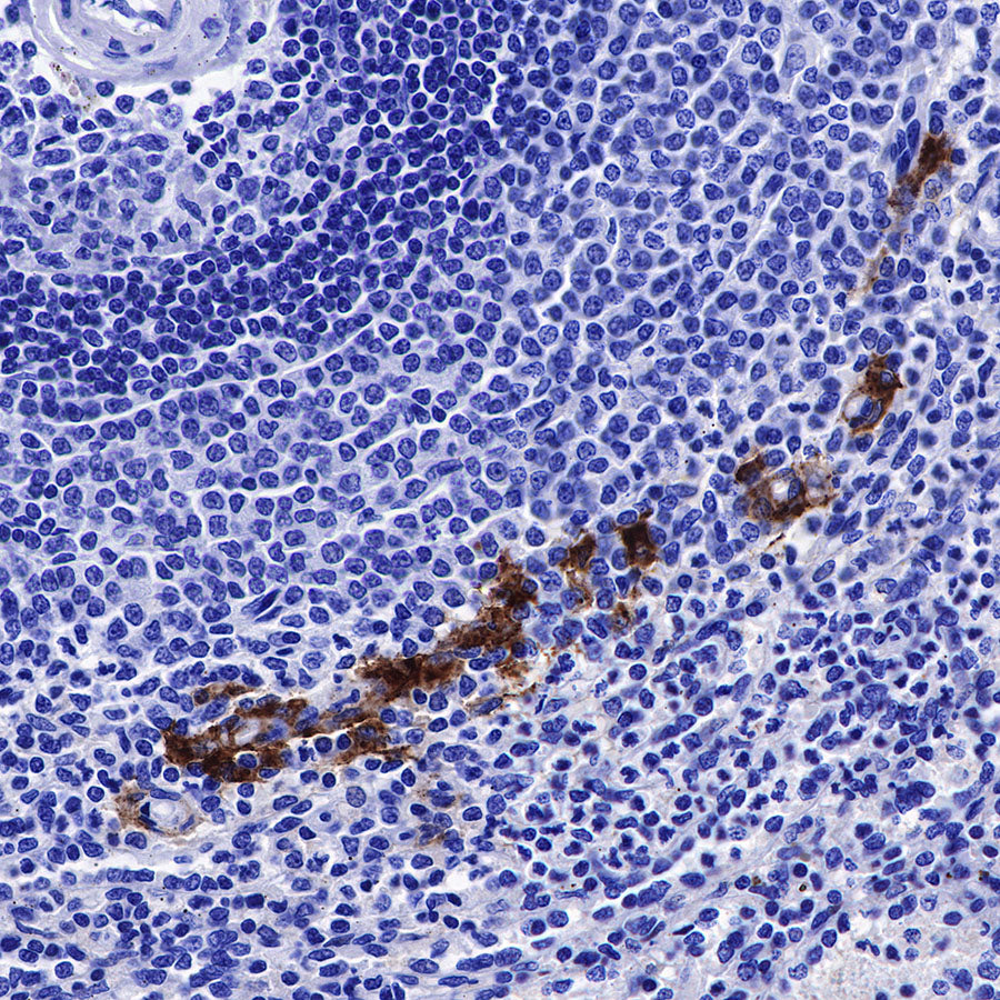 CD169 Recombinant Rabbit mAb (SDT-R153)