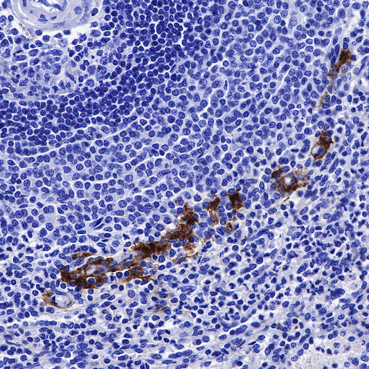 CD169 Recombinant Rabbit mAb (SDT-R153)