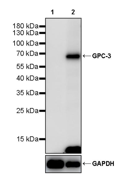 Glypican-3 Recombinant Rabbit mAb (SDT-4064-69)