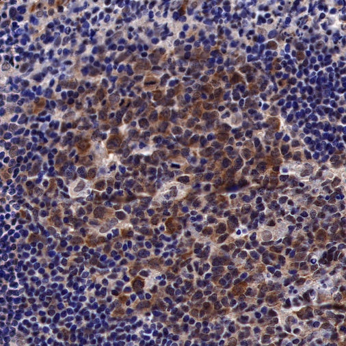 Keap1 Recombinant Rabbit mAb (S-1520-8)