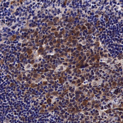 Keap1 Recombinant Rabbit mAb (S-1520-8)