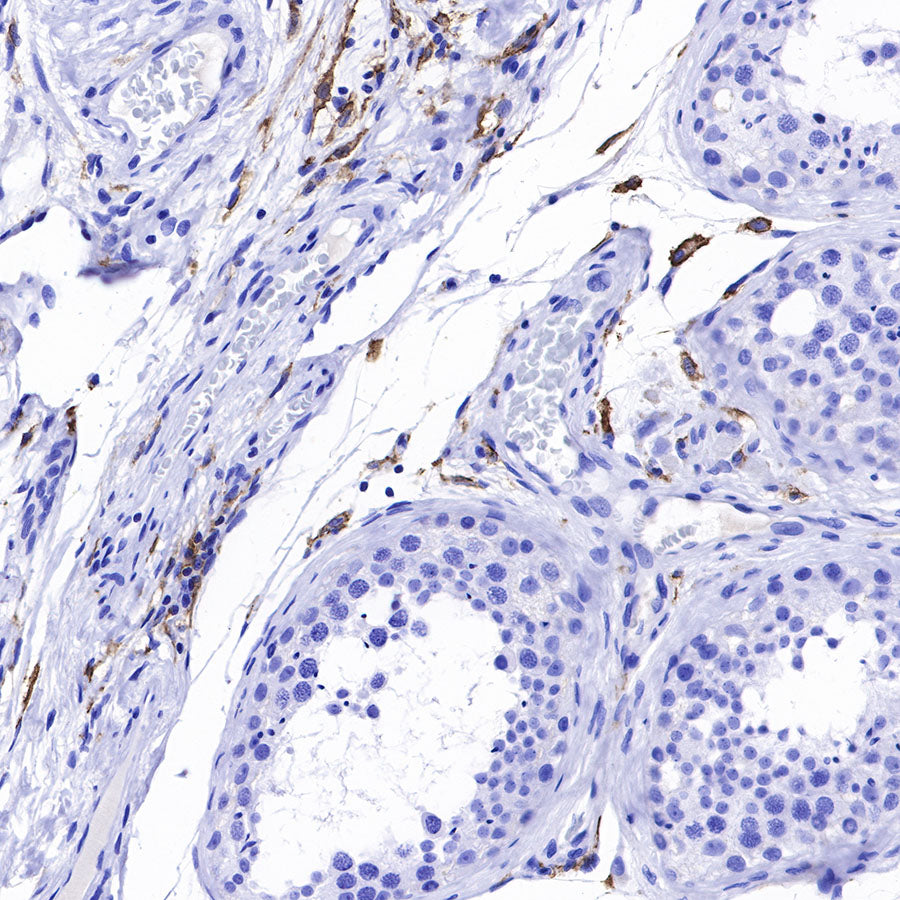 CD169 Recombinant Rabbit mAb (SDT-R153)