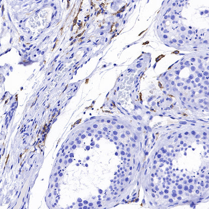 CD169 Recombinant Rabbit mAb (SDT-R153)
