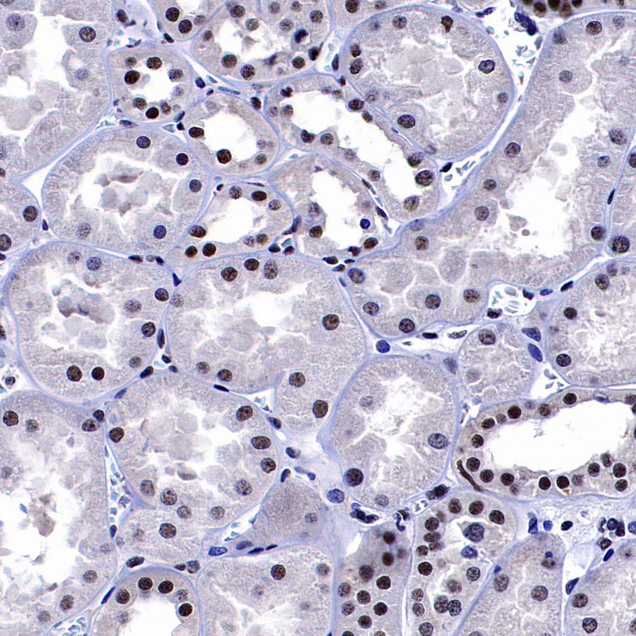 DDX39B Recombinant Rabbit mAb (S-4549-30)