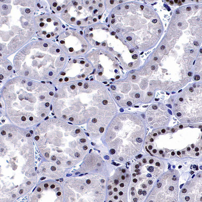 DDX39B Recombinant Rabbit mAb (S-4549-30)