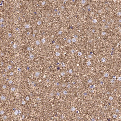 PKA C-α Recombinant Rabbit mAb (S-2564-5)