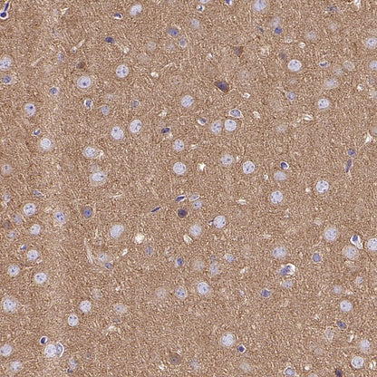 PKA C-α Recombinant Rabbit mAb (S-2564-5)