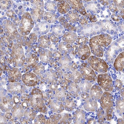 ATG12 Recombinant Rabbit mAb (S-1143-209)
