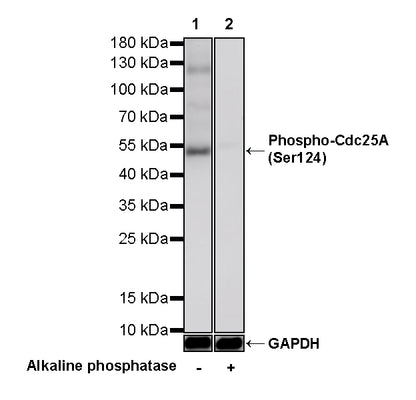 Phospho-Cdc25A (Ser124) Recombinant Rabbit mAb (S-5057-5)