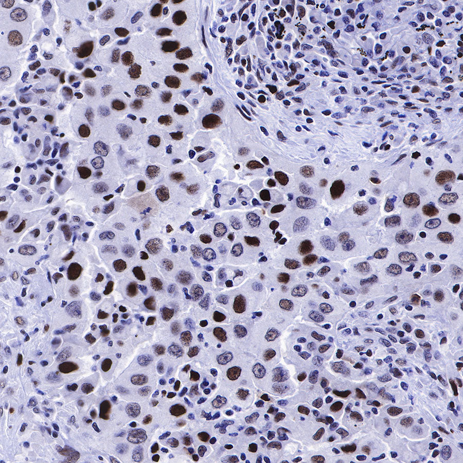S-RMab® MCM2 Recombinant Rabbit mAb (SDT-018-68)