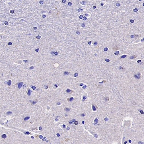 Cytokeratin 6A (KRT6A) Recombinant Mouse mAb (SDT-3380)