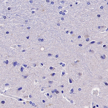 Cytokeratin 6A (KRT6A) Recombinant Mouse mAb (SDT-3380)