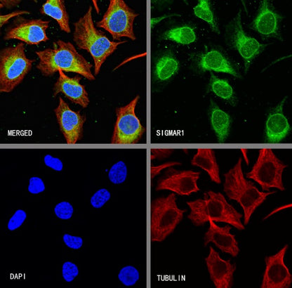 SIGMAR1 Recombinant Rabbit mAb (S-2079-270)