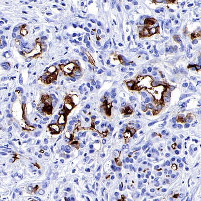 MUC1/EMA Mouse mAb (SDT-777-37)